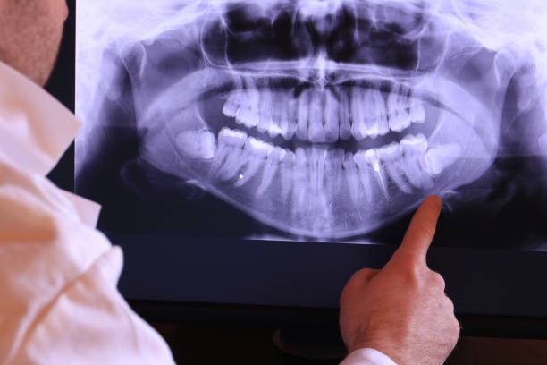 Best Emergency Root Canal Treatment in Roseto, PA